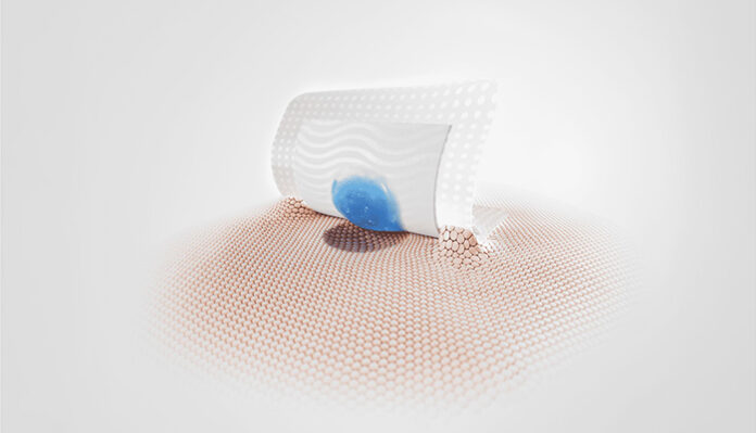 Tacnera® from Freudenberg solves the adhesion-trauma problem. Source: ©Freudenberg Performance Materials